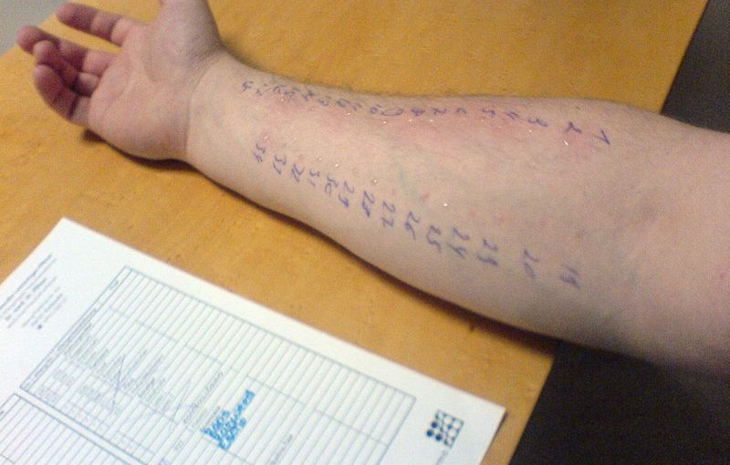Rodzaje testów alergicznych
